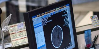 Tumori, codice a barre genetico traccia cellule cancro cervello: studio italiano