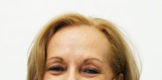 E’ morta Caterina Catricalà, dermatologa ed esperta di melanoma