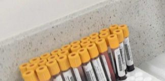 D’Arminio Monforte (Icona), ‘riportare i giovani a ricerca clinica su Hiv’