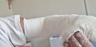 Roma, la volontaria aggredita a Tor Bella Monaca: “Diamo fastidio a pusher, ma non mi arrendo”