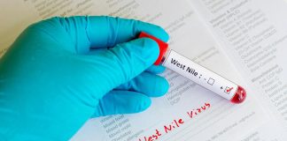 West Nile, 4 nuove morti in Italia: casi salgono a 283