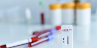 Covid, antivirali e terapie: ecco le nuove linee guida sul trattamento del virus