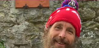 Jovanotti: “Non cammino ancora senza stampelle, che casino ho combinato!”