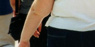 Obesità e cuore stanco, il mix toglie 6 anni di vita