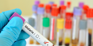 Sanità, Oms: “Capo Verde malaria-free, traguardo storico”