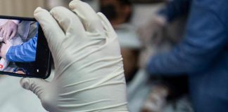 Vaiolo delle scimmie, undici casi a Firenze: cosa sappiamo