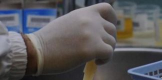 Cancro alle ovaie, studio apre a test delle urine per scoprirlo