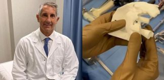 Chirurgia, protesi di spalla rovinata sostituita con un modello personalizzato