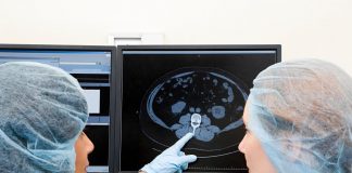 Kinsella e il cancro al cervello, cos’è il glioblastoma che l’ha colpita
