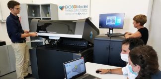 Medicina, milza su misura con stampa 3D per pianificare intervento