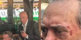Barillari picchiato da Depardieu in via Veneto finisce in ospedale. Il fotoreporter: “Mo lo denuncio”