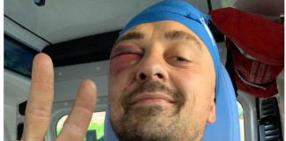 Chef Rubio aggredito sotto casa: “Mi hanno massacrato di botte”