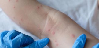 Dermatologi, subito task force per formare medici su Ai