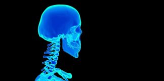 Sindrome della ‘testa che scivola sul collo’, come riconoscerla e trattarla