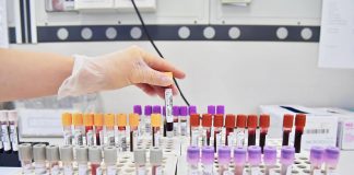 Uap: “Governo argini fondi Regioni a farmacie per attività pre-diagnostica”