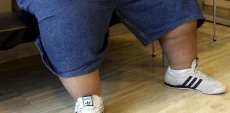 Nutrizionista, ‘senza politiche anti-obesità meno anni di vita per generazioni future’