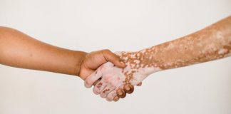Malattie della pelle, Salutequità “Più programmazione e reti dedicate”