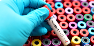 Epatite C, Oms prequalifica il primo test fai-da-te