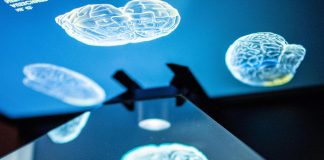 Alzheimer, Ema blocca farmaco Lecanemab: “Rischio di gravi effetti collaterali”