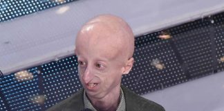 Vaiolo delle scimmie, su X fake news con la foto di Sammy Basso: è bufera social