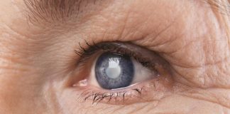 Via cataratta senza operarsi, dal segreto di uno scoiattolo possibile farmaco