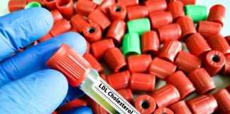 Studio, aggiunta di acido bempedoico riduce in modo efficace colesterolo Ldl