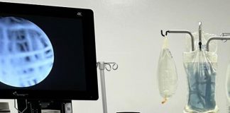 Tumore del seno triplo negativo, immunoterapia prima e dopo chirurgia aumenta sopravvivenza
