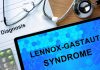 Lo studio, più di 1 anno per una diagnosi di sindrome di Lennox-Gastaut