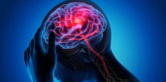 Padovani (Sin): “In Italia 32 mln con disturbi neurologici ma diagnosi è spesso tardiva”