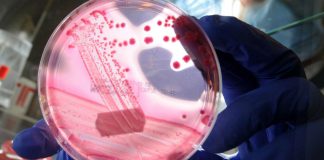 Escherichia coli in hamburger McDonald’s, 90 i casi: scoperta la causa