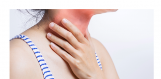 Cambio di stagione: prevenire e curare il mal di gola con semplici rimedi