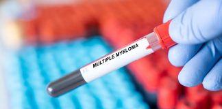 Ail: “Per pazienti con mieloma multiplo difficoltà principale è arrivare a diagnosi”