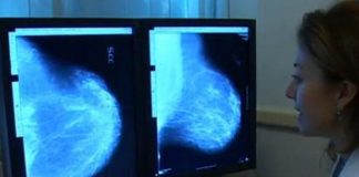 Cancro al seno, un nanofarmaco potrebbe bloccare le metastasi: lo studio