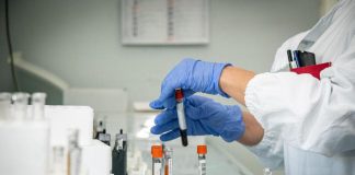Malattia Congo, Oms: “891 casi mix virus, malaria e malnutrizione”