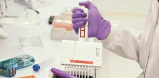 Torna dal Congo e muore, Spallanzani: “Malaria nel sangue”