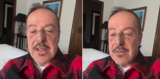 Massimo Lopez, investito a Roma da moto pirata: il video sui social