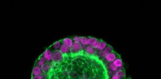 Ricerca: passo verso creazione cuore a partire da cellule staminali pluripotenti