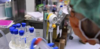 Malattia Congo e malaria grave: le novità sul virus misterioso, cosa sappiamo