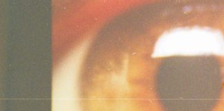 Rilancio Holostem, terapia salva-cornea a 1 paziente e già altri in lista