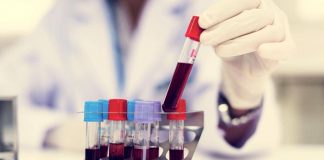 Cancro infantile, un prelievo di sangue predirà evoluzione ed efficacia cure