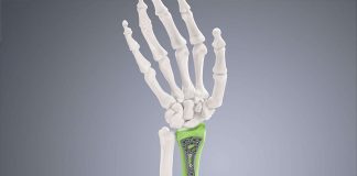 Tecniche di pre-riscaldamento nella stampa 3D in titanio