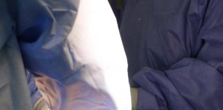 Roma, muore a 62 anni dopo liposuzione in una clinica privata