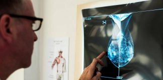 Cancro al seno, crioablazione nuova frontiera di cura