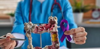 Tumori, colorettale metastatico refrattario, ok Aifa a rimborsabilità nuova terapia