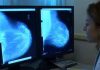 Donne operate per tumore al seno, 70% paga cure e 30% teme per il lavoro