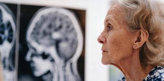 Giornata salute donne, Sin ‘prendetevi cura anche della salute neurologica’