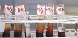 Salute, da Hiv a infezioni sessuali lotta a sommerso, al via settimana europea test