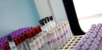Mielofibrosi, speranze da nuovo farmaco che limita l’anemia in 2 pazienti su 3