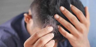 Il dermatologo: “Con alopecia areata disagi e costi alti, svecchiare linee guida”