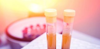 Farmaci, Sava (Sif Magazine): “In plasmaderivati attenzione particolare a sicurezza”